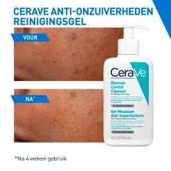 CeraVe Anti-Onzuiverheden Reinigingsgel Outlet