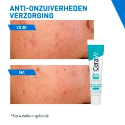 CeraVe Geconcentreerde Anti-Onzuiverheden Verzorging New