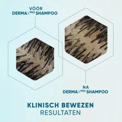 Head & Shoulders DermaXPro by Kalmeert Antiroosshampoo New