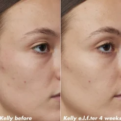 ELF e.l.f. Skin PLZ Clarify Facial Oil Clearance