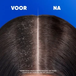 Head & Shoulders Apple Fresh Antiroosshampoo Online