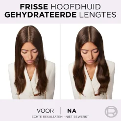 Elvive L'Oréal Paris Hyaluron Pure Hydraterende Conditioner Outlet