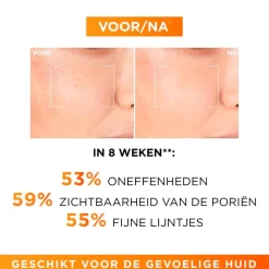 L'Oreal Paris L'Oréal Paris Revitalift Clinical Pure Vitamine C 12% Serum Outlet