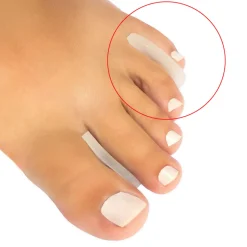 Medical Brace Siliconen Teenverdelers New