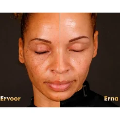 Nivea Skincare NIVEA Cellular Luminous630 Anti-Spot SPF50 Dagcrème Outlet