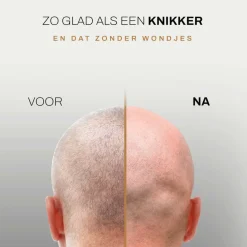 Sansbeauté Hoofdscheerapparaat - Skull Shaver - Skullsharp PRO Online