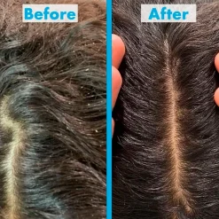 Umberto Giannini Scalp Restore Shampoo Clearance